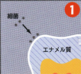 虫歯予防 伊東市 熱海市 宇佐美 うさみ 歯医者 小児歯科