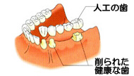 ɓs Cvg F  MCs